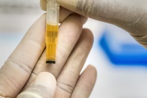 When to get your urine tested when on keto